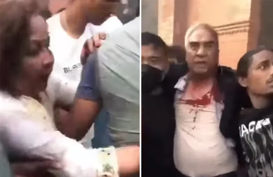 देउवा दम्पतीमाथि कुटपिट